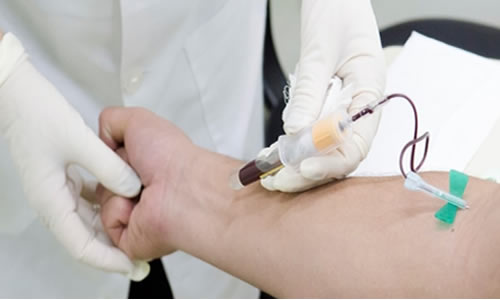 Exame de dengue: os planos de saúde cobrem isso?
