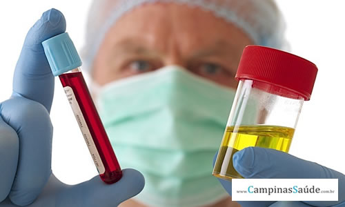 Urina escura é sinal de infecção? Urina escura é sinal de infecção?