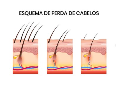 8 coisas que você provavelmente não sabia sobre o minoxidil